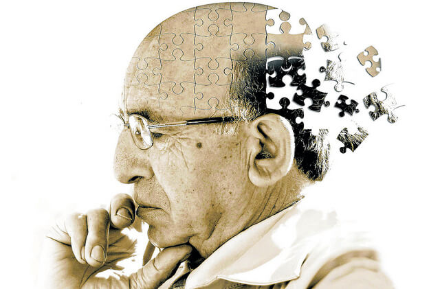 Demenza di Alzheimer: come trattare la perdita di memoria